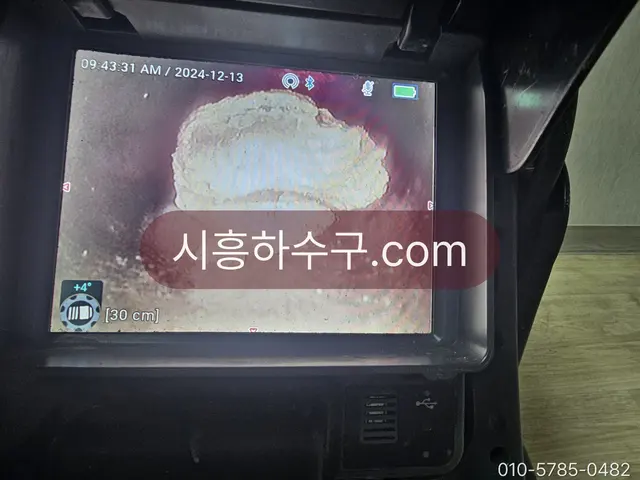 내시경 화면에 잡힌 관 안 이물과 침하 구간